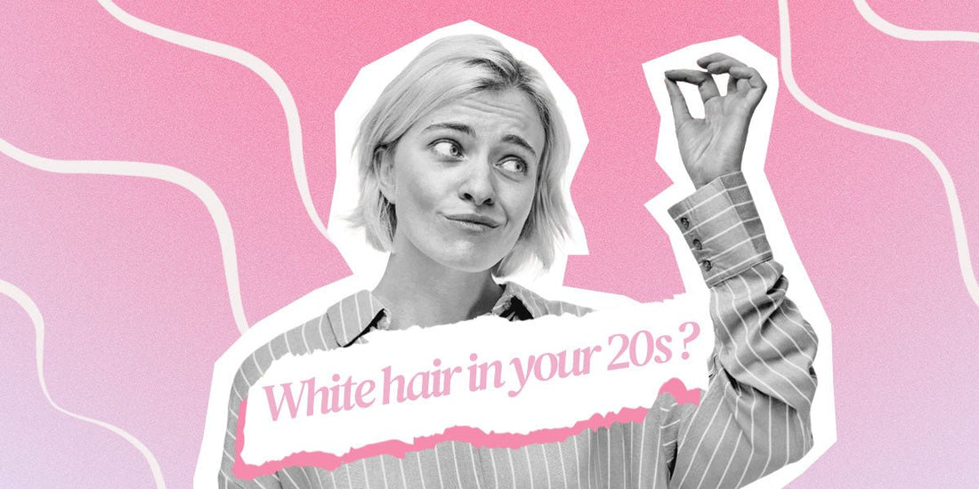 Have White Hair In Your 20s?.