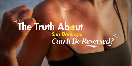 Image shows a woman with sunburn and overlayed text with 'the Truth About Sun Damage: Can it be reversed?'
