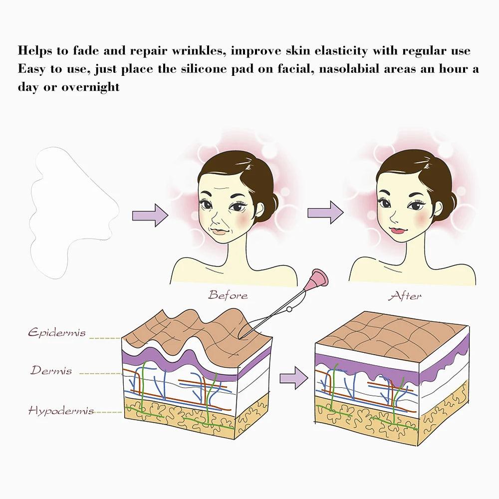 Facial Wrinkle Remover Silicone Pad — Reusable Nasolabial Fold Patch