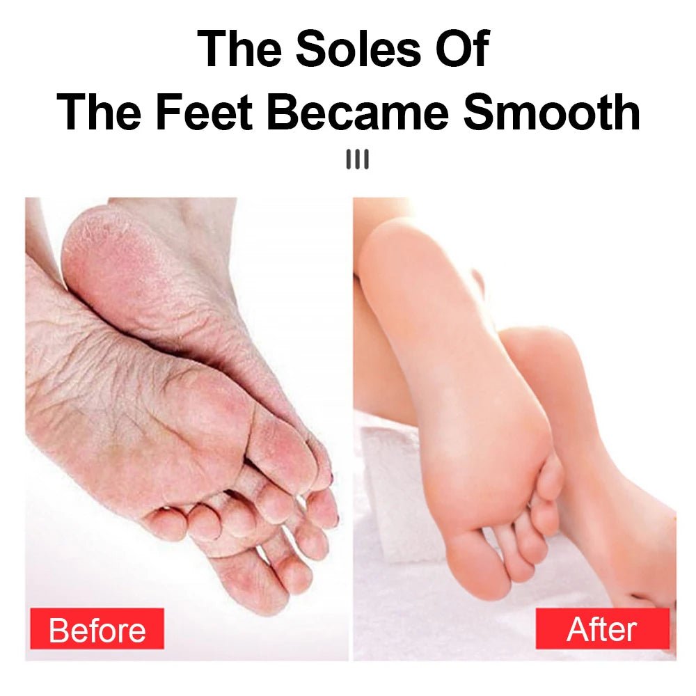 Nano Glass Foot Grinder Remove Dead Skin - Radiance Revolution