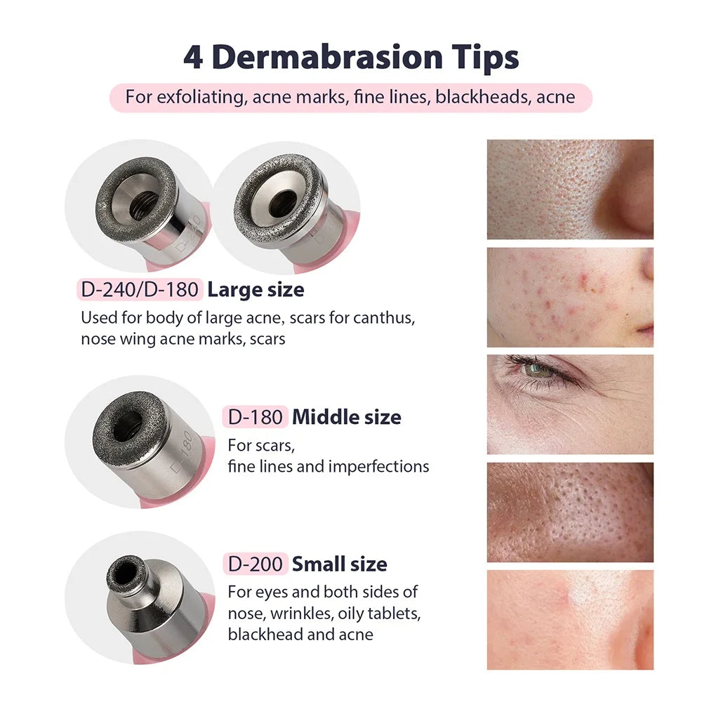 2 in 1 Portable Microdermabrasion Exfoliator & Blackhead Suction Device.