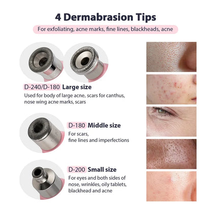 2 in 1 Portable Microdermabrasion Exfoliator & Blackhead Suction Device.