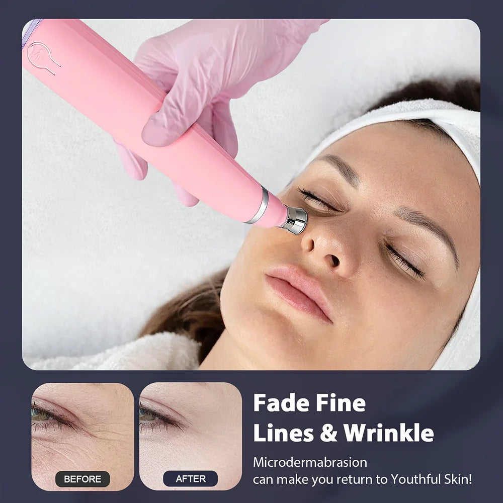 2 in 1 Portable Microdermabrasion Exfoliator & Blackhead Suction Device.