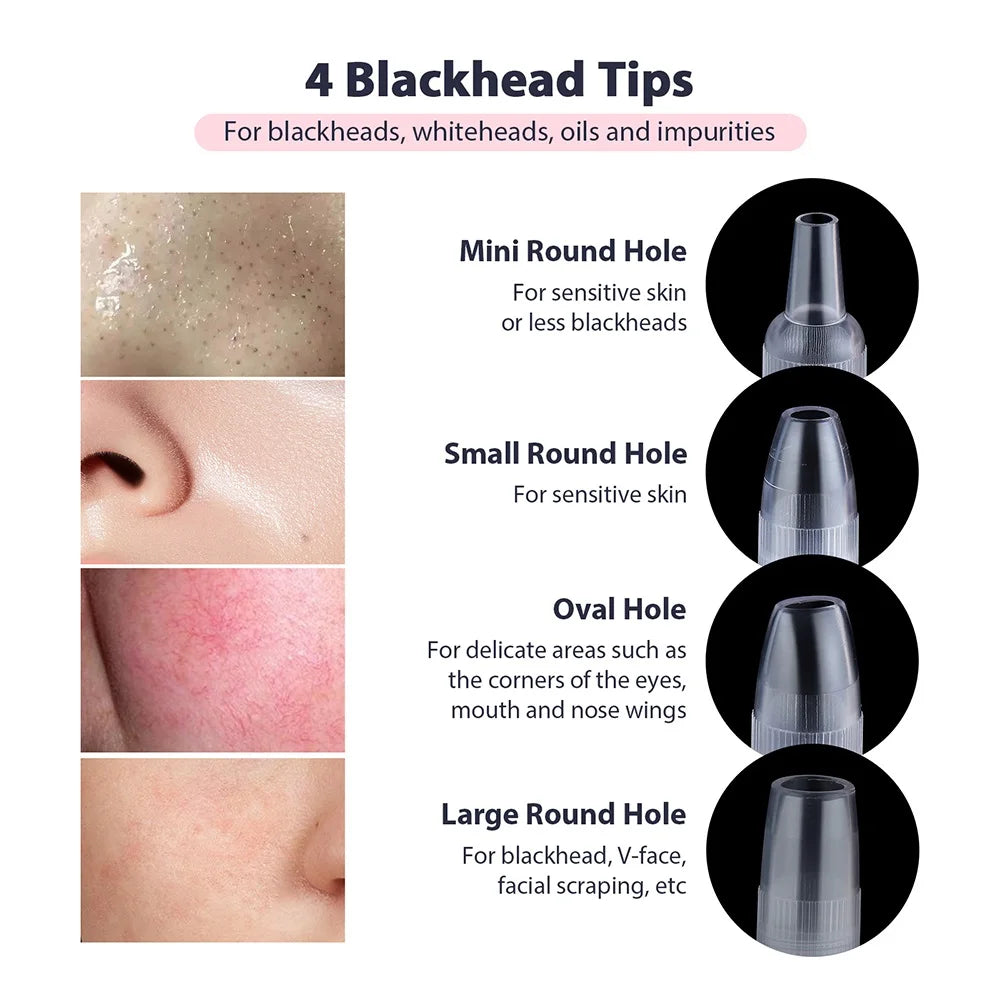 2 in 1 Portable Microdermabrasion Exfoliator & Blackhead Suction Device.