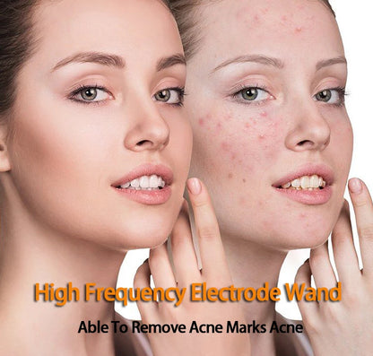 4 Types High Frequency Facial Machine Electrotherapy Wand Glass Tube Skin Tightening Device Beauty Products Anti Wrinkle