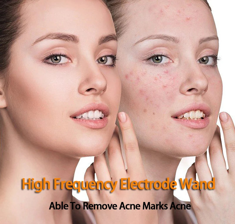 9 Types High Frequency Replacement Electrodes Glass Tube Facial Electrotherapy Wand Acne Spot Remover Beauty Device