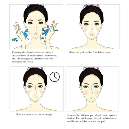 Facial Wrinkle Remover Silicone Pad — Reusable Nasolabial Fold Patch