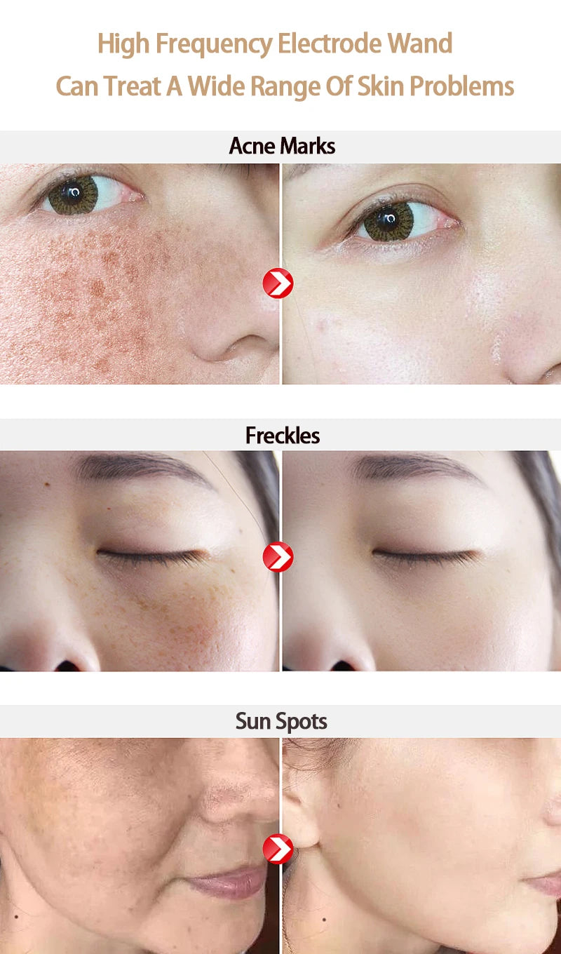 9 Types High Frequency Replacement Electrodes Glass Tube Facial Electrotherapy Wand Acne Spot Remover Beauty Device