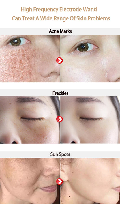 9 Types High Frequency Replacement Electrodes Glass Tube Facial Electrotherapy Wand Acne Spot Remover Beauty Device
