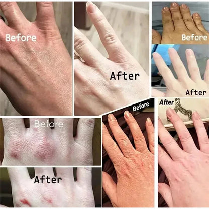 Kojic Acid Whiten Hand Cream,Moisturizing Nourishing Niacinamide Hyaluronic Acid Tender Hand Lotion,Foot Skin Care Products.