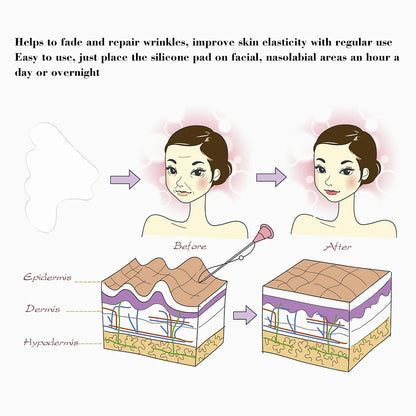 Facial Wrinkle Remover Silicone Pad — Reusable Nasolabial Fold Patch