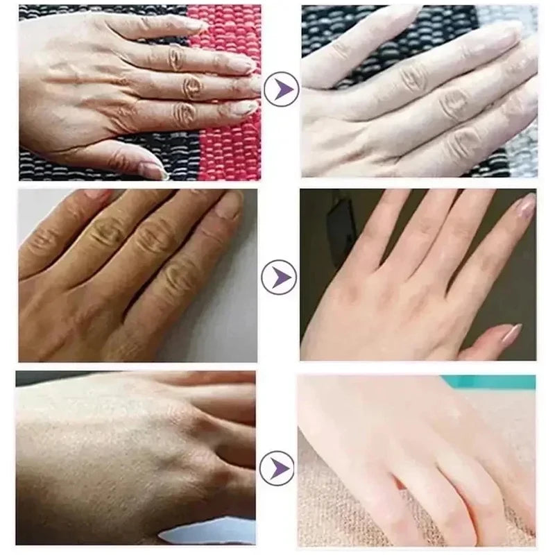 Kojic Acid Whiten Hand Cream,Moisturizing Nourishing Niacinamide Hyaluronic Acid Tender Hand Lotion,Foot Skin Care Products.