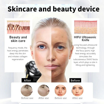 New Mini Hifu 4 In1 Ultrasonic Machine Ems Micro  Current Face Lift Rejuvenating Wrinkle Resistant Massager.