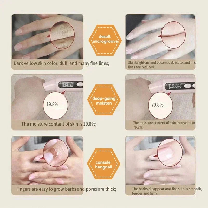 Kojic Acid Whiten Hand Cream,Moisturizing Nourishing Niacinamide Hyaluronic Acid Tender Hand Lotion,Foot Skin Care Products.