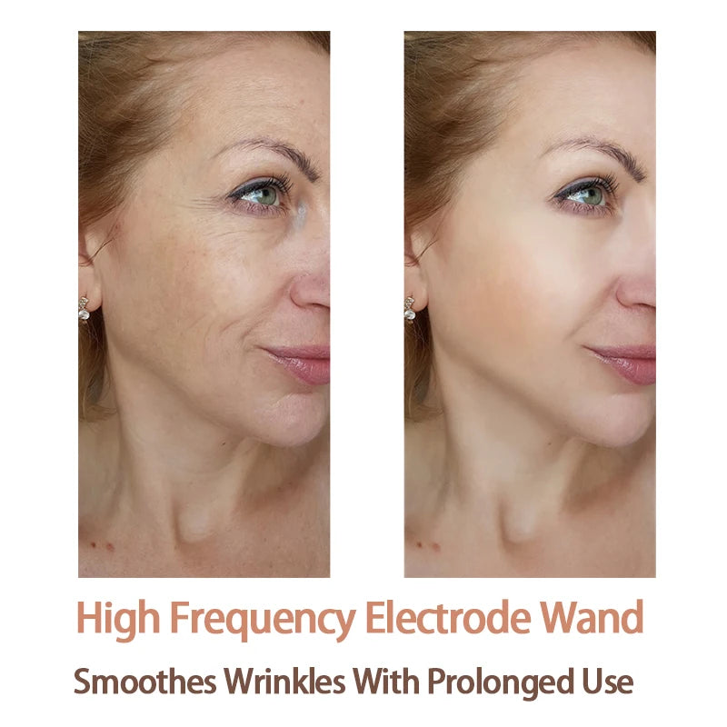 4 Types High Frequency Facial Machine Electrotherapy Wand Glass Tube Skin Tightening Device Beauty Products Anti Wrinkle