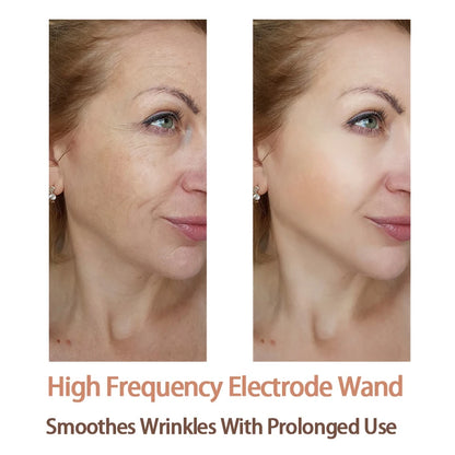 9 Types High Frequency Replacement Electrodes Glass Tube Facial Electrotherapy Wand Acne Spot Remover Beauty Device