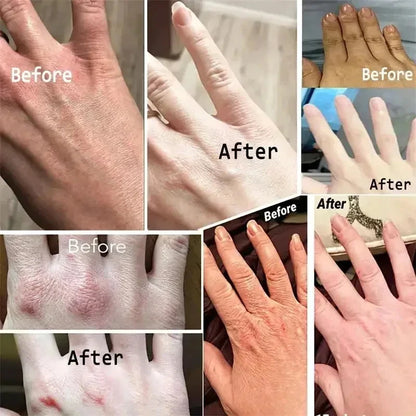 Kojic Acid Whiten Hand Cream,Moisturizing Nourishing Niacinamide Hyaluronic Acid Tender Hand Lotion,Foot Skin Care Products.
