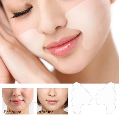 Facial Wrinkle Remover Silicone Pad — Reusable Nasolabial Fold Patch