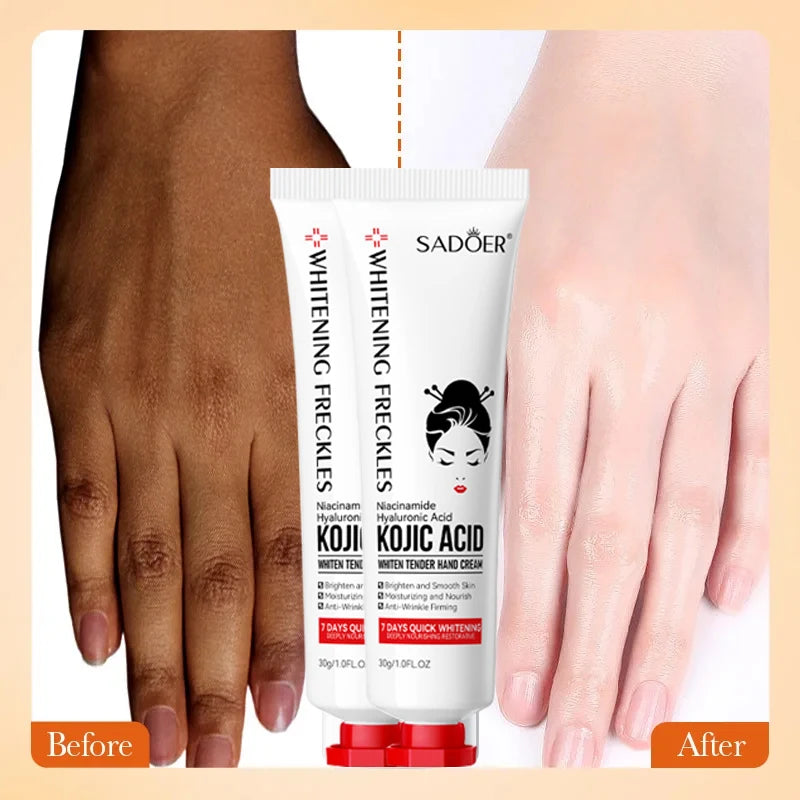 Kojic Acid Whiten Hand Cream,Moisturizing Nourishing Niacinamide Hyaluronic Acid Tender Hand Lotion,Foot Skin Care Products.