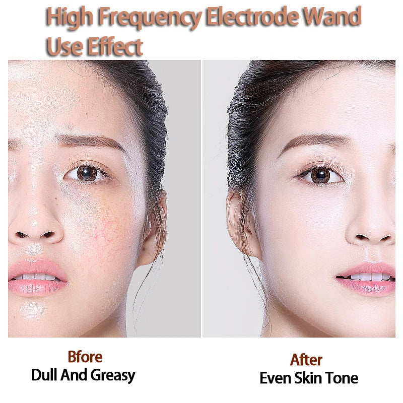 4 Types High Frequency Facial Machine Electrotherapy Wand Glass Tube Skin Tightening Device Beauty Products Anti Wrinkle