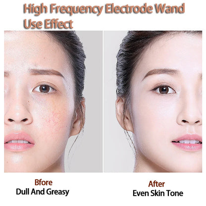4 Types High Frequency Facial Machine Electrotherapy Wand Glass Tube Skin Tightening Device Beauty Products Anti Wrinkle