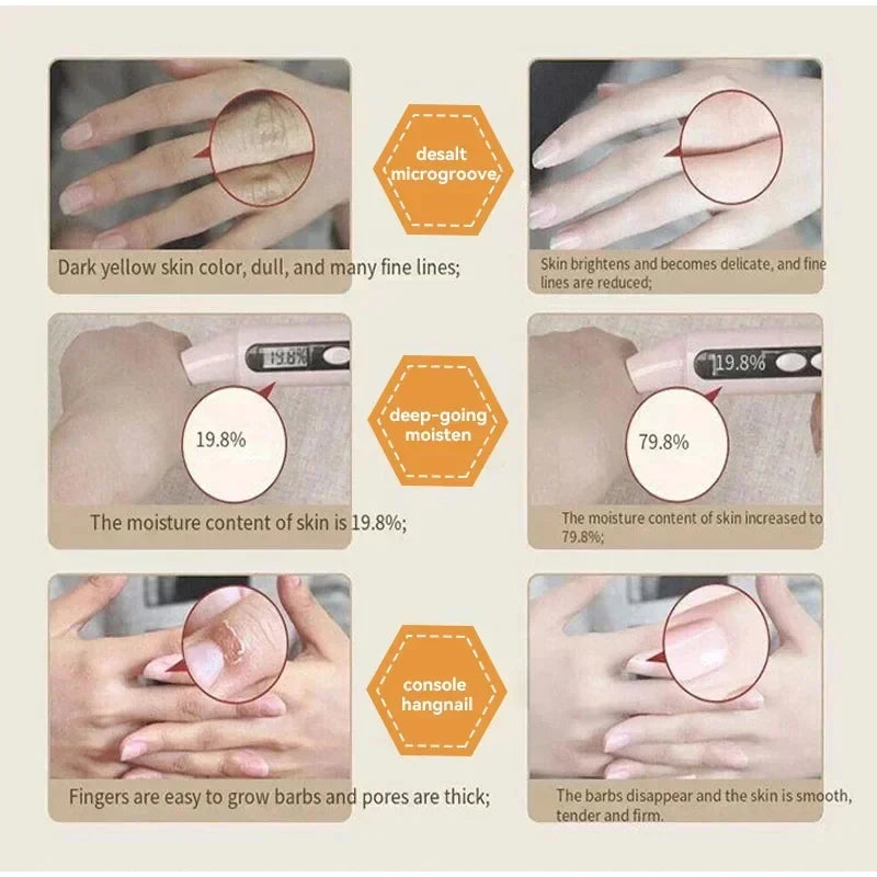 Kojic Acid Whiten Hand Cream,Moisturizing Nourishing Niacinamide Hyaluronic Acid Tender Hand Lotion,Foot Skin Care Products.