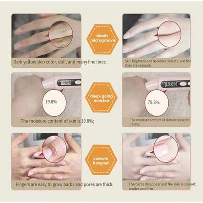 Kojic Acid Whiten Hand Cream,Moisturizing Nourishing Niacinamide Hyaluronic Acid Tender Hand Lotion,Foot Skin Care Products.
