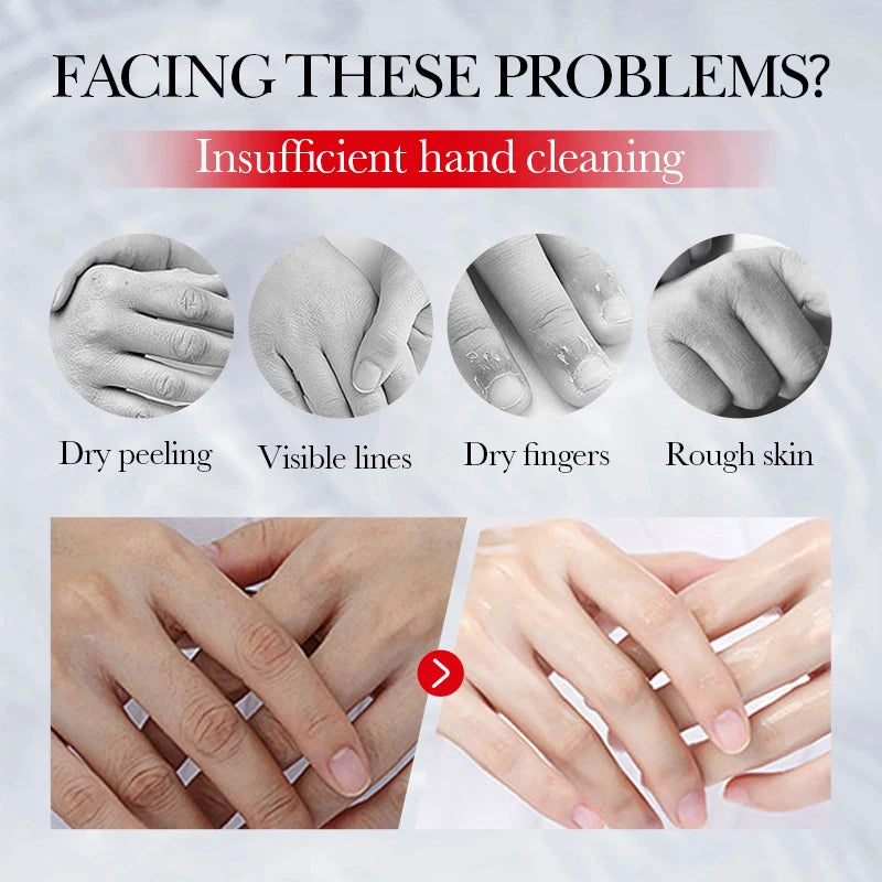 Kojic Acid Whiten Hand Cream,Moisturizing Nourishing Niacinamide Hyaluronic Acid Tender Hand Lotion,Foot Skin Care Products.