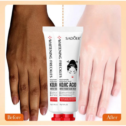 Kojic Acid Whiten Hand Cream,Moisturizing Nourishing Niacinamide Hyaluronic Acid Tender Hand Lotion,Foot Skin Care Products.