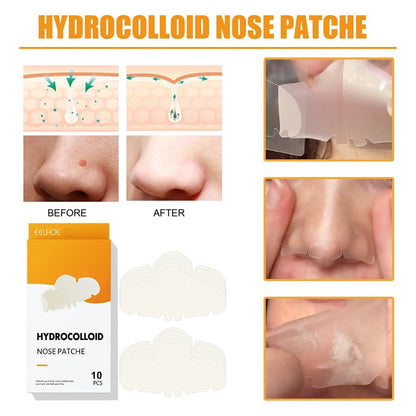 Pimple Nose Patch 10pcs - Radiance Revolution - CHINA - nose patch - Generic