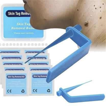 Skin Tag Removal Kit - Radiance Revolution - Default Title - Tag Removal - Generic