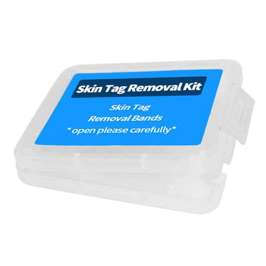 Skin Tag Removal Kit - Radiance Revolution - Default Title - Tag Removal - Generic